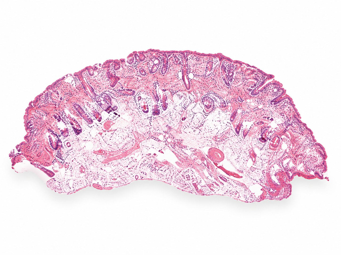 High-resolution, high-contrast digital image of fresh skin tissue