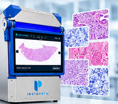 Nova imaging system alongside digital images of stained tissue